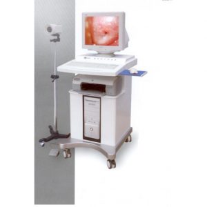 Máy Soi Cổ Tử Cung